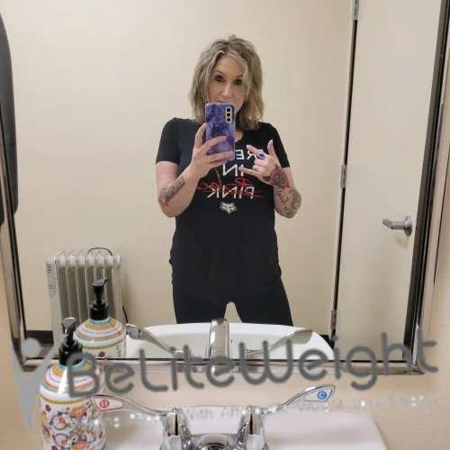 Weight Loss Surgery Before And After Jodi K - 1 Year Update*